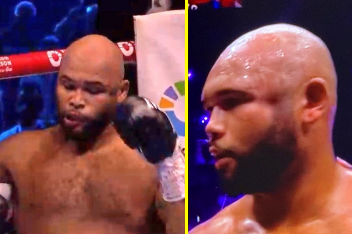 'Never seen anything like it' - Frazer Clarke left with a huge dent in the side of his head after Fabio Wardley's stunning first round KO